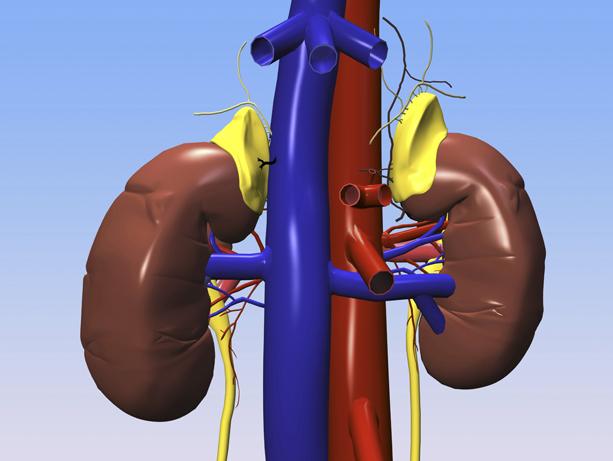 Medical Compass: Sodium's stealthy assault on your kidneys